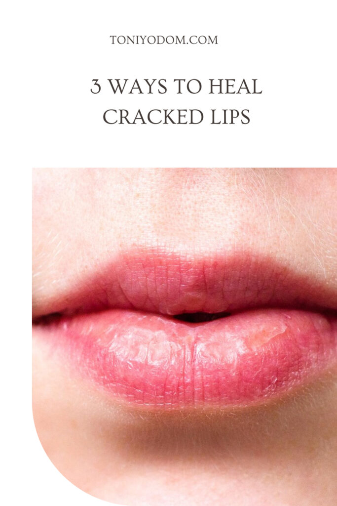 dry lips